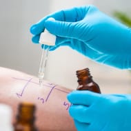 Exames | Prick-Test | Policlínica de Corrente